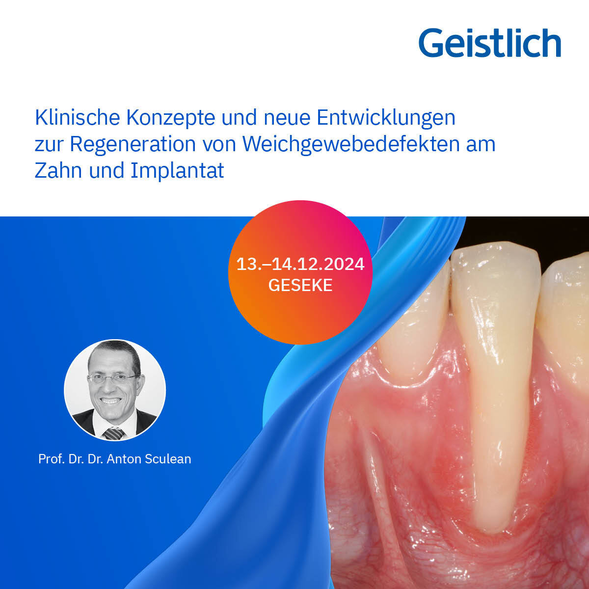 Klinische Konzepte und neue Entwicklungen zur Regeneration von Weichgewebedefekten am Zahn und Implantat